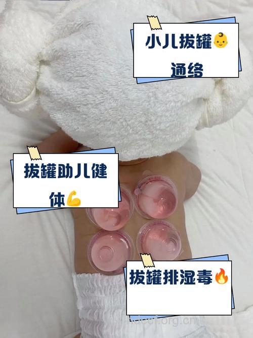 宝宝受凉腹泻可以拔罐治疗吗?