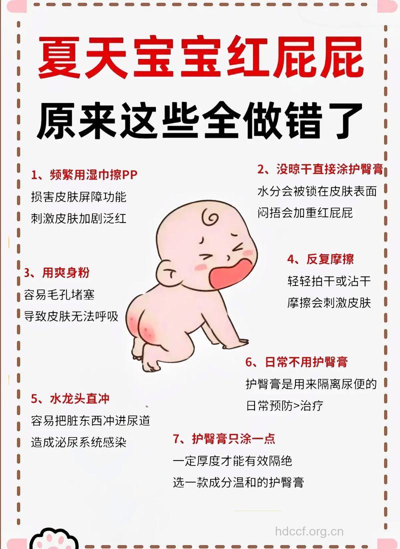 夏季炎炎 如何护理宝宝屁股