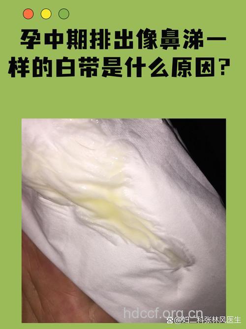 怀孕早期 准妈白带有哪些变化