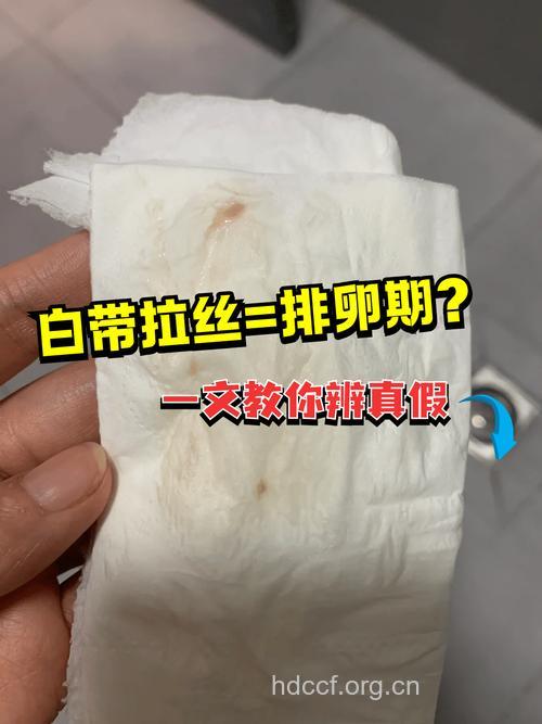 网友好孕经验分享 白带拉丝不一定是排卵日