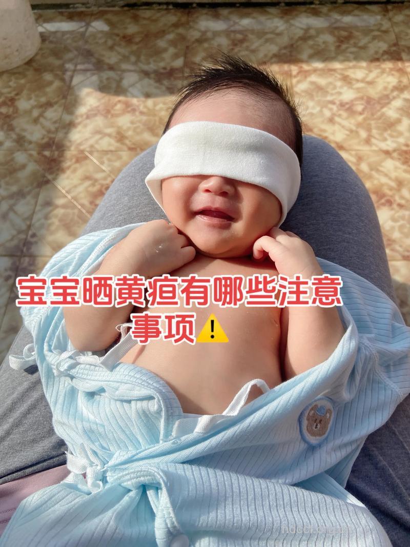 早产儿黄疸能够消退吗