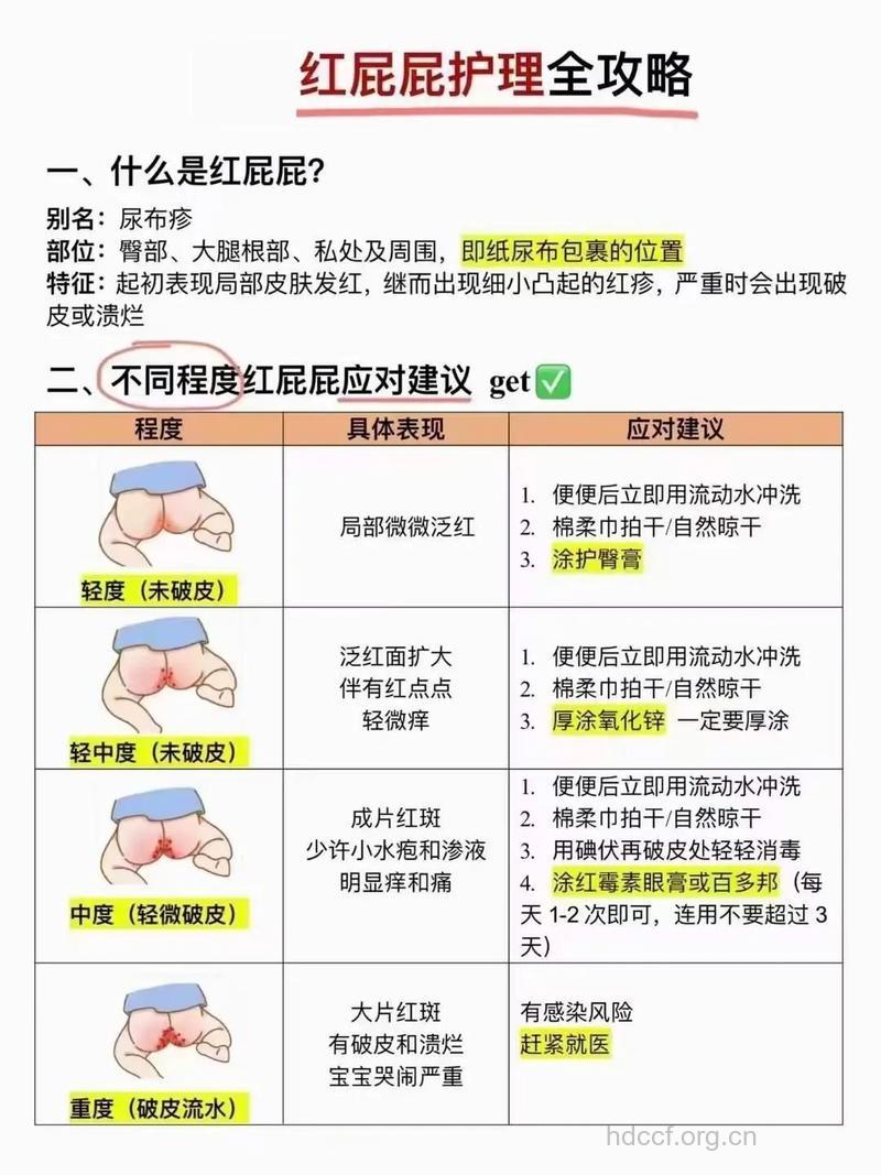 新妈妈护理红屁股的6个方法