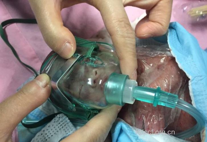 新生儿窒息缺氧性实验