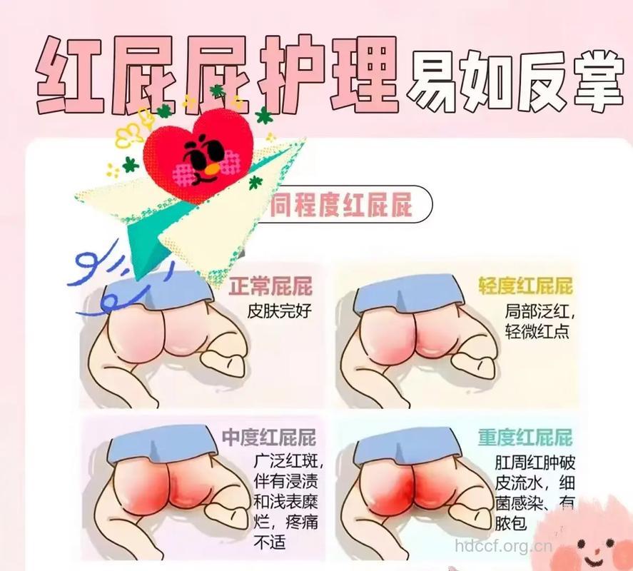 夏天怎么对待宝宝“红屁股”