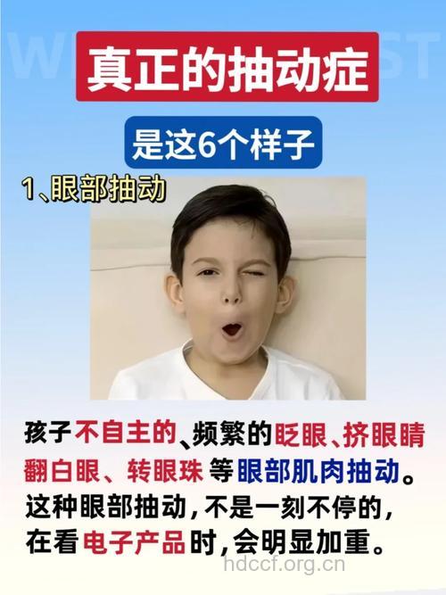 抽动症有什么典型症状呢