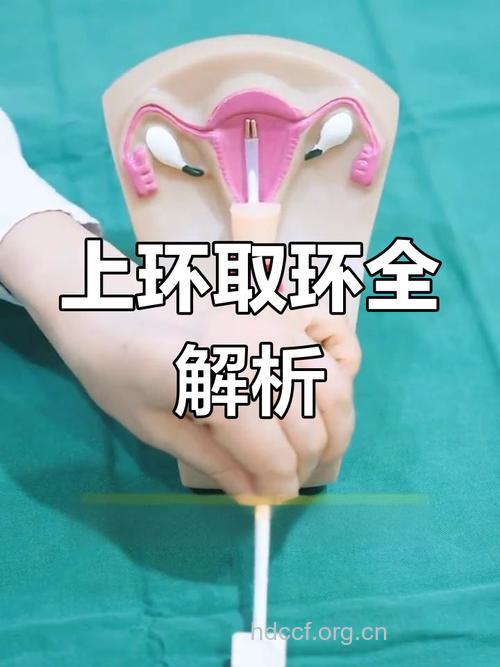 女人取环会痛吗 取环前要做好哪些准备