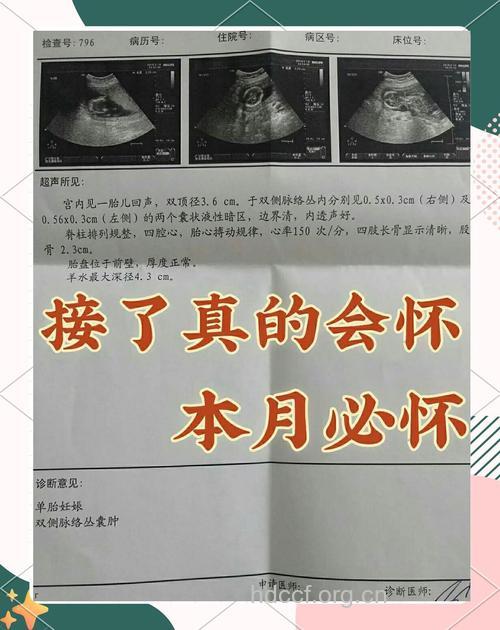 备孕二个月 成功好孕经验分享