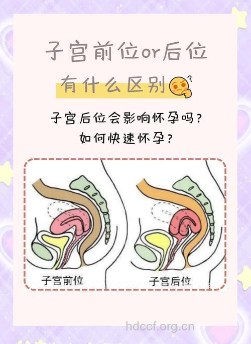 备孕先看子宫好不好 注意3大方面