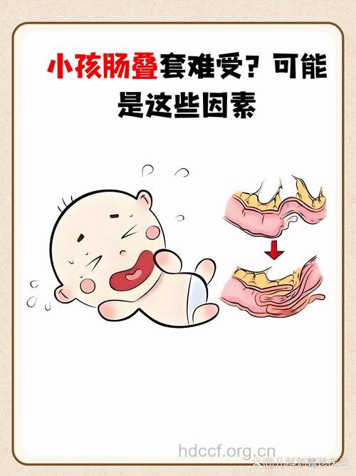 小儿肠套叠的症状有哪些