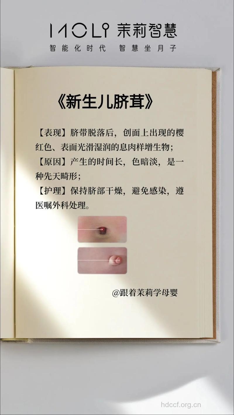 全面解析新生儿脐茸