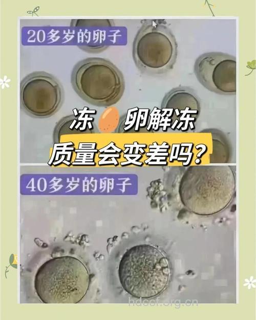 冷冻卵子 最好在35岁以前进行卵子冷冻