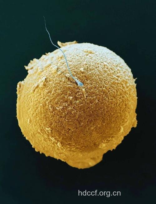 卵子是什么样的 卵子排出是什么颜色