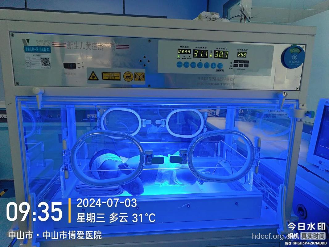 新生儿黄疸病因病机是什么