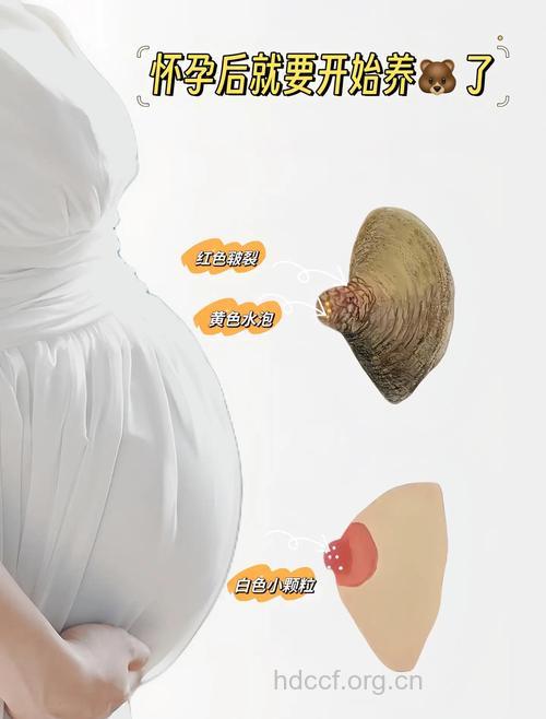 孕妇这3个部位变黑怎么办 教你一招应对