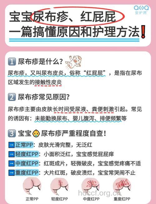 引起宝宝尿布疹的病因
