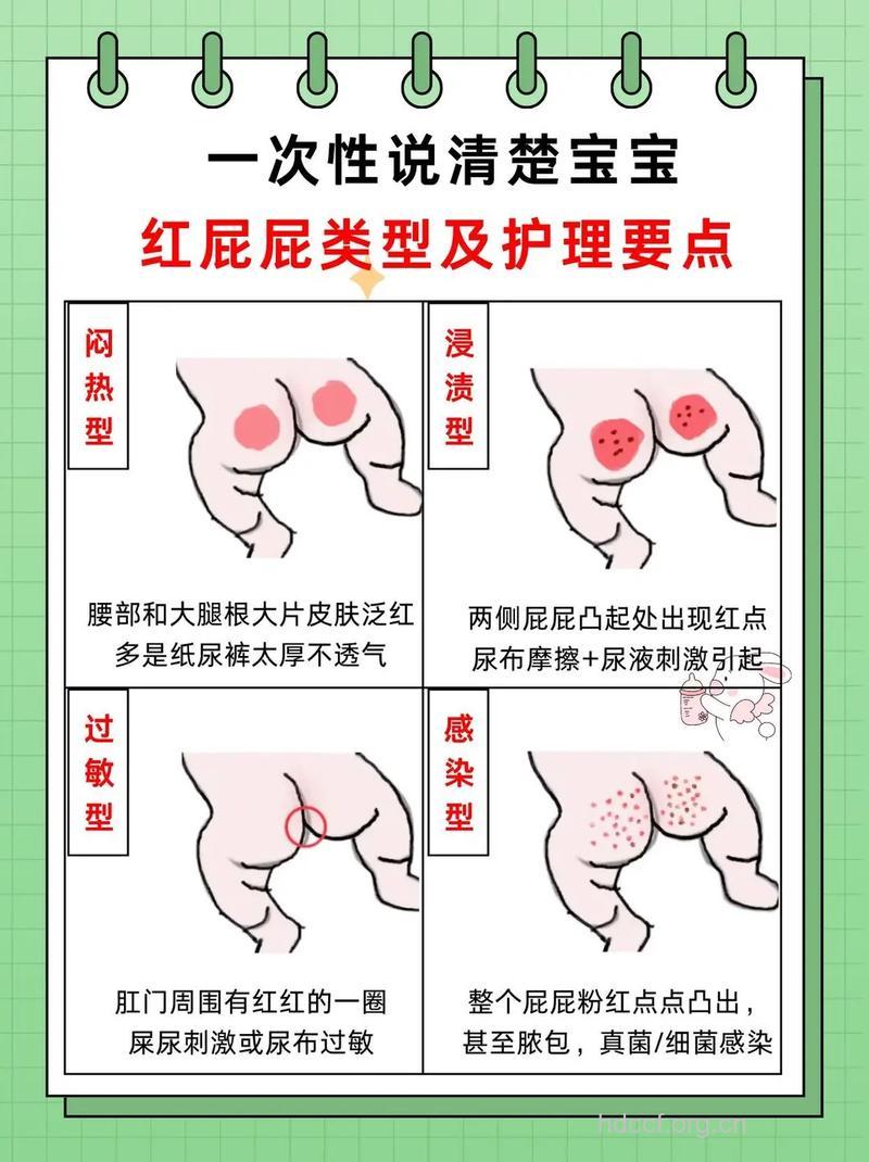 宝宝红臀的诱发因素