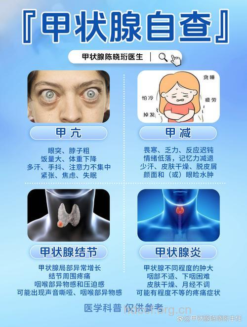 备孕女性一定要做好甲状腺检查