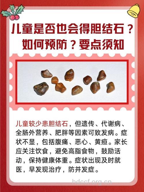结石宝宝的成因及治疗方法