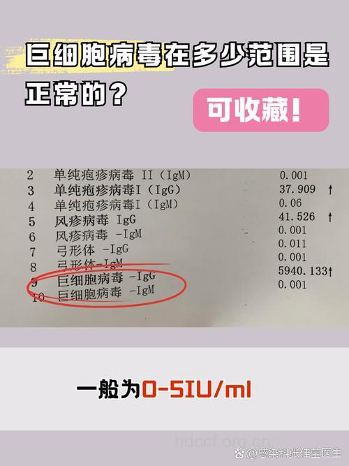 巨细胞病毒感染知多少