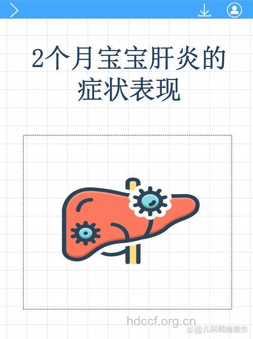 新生儿肝炎有那些特征