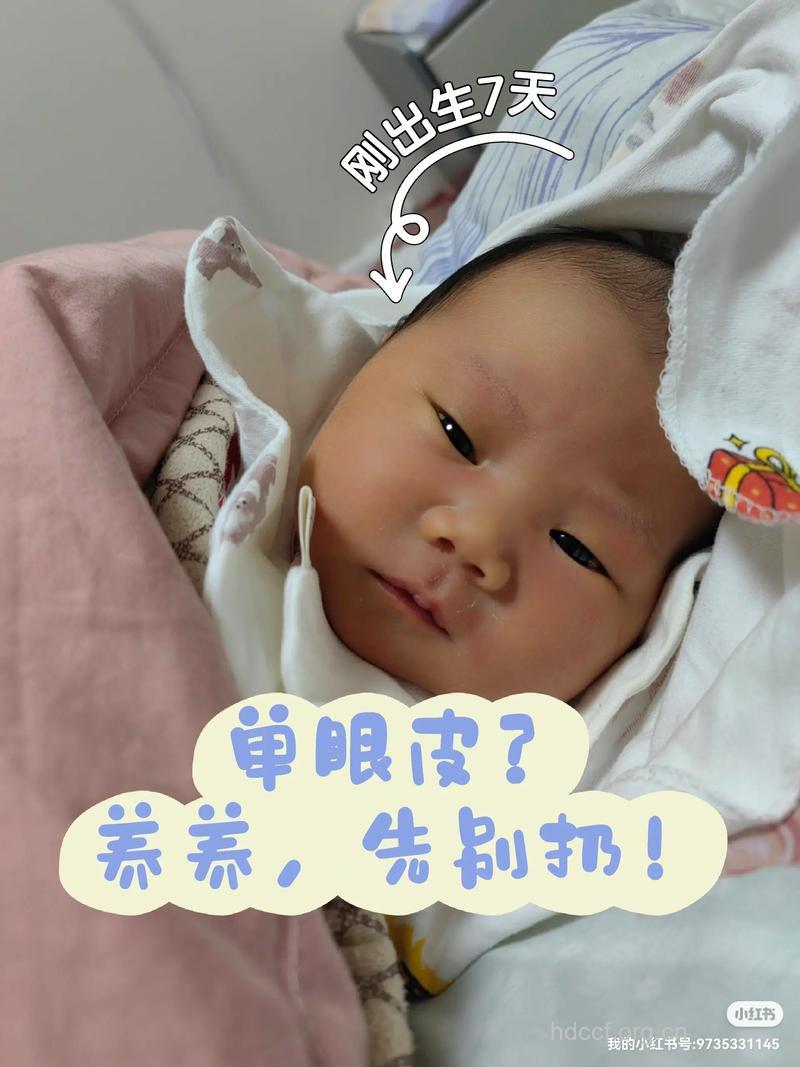 宝宝单眼皮or双眼皮 由谁决定