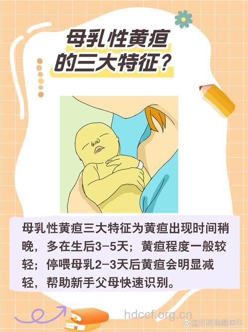什么是母乳性黄疸以及特点?