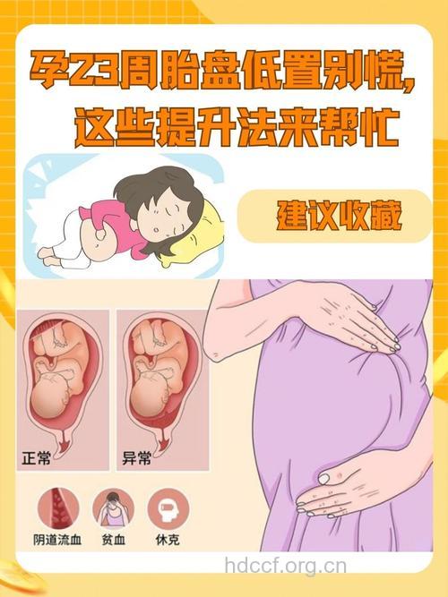 孕妇胎盘低置怎么办
