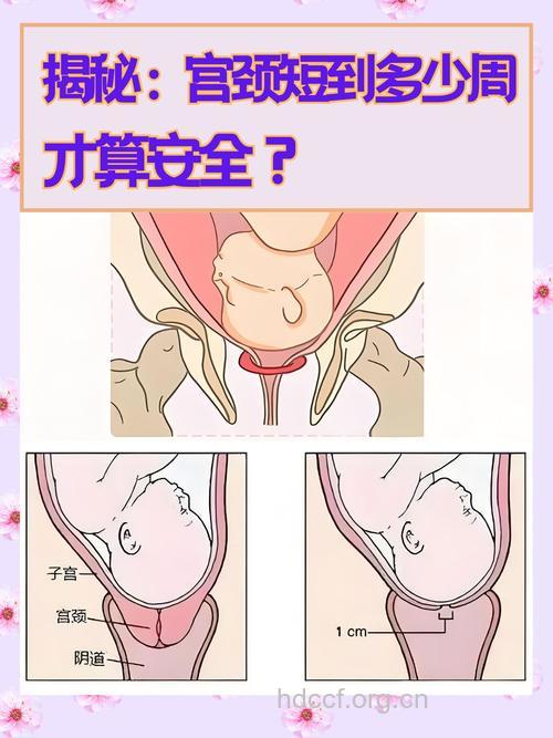 孕妈妈要注意私处4类变化