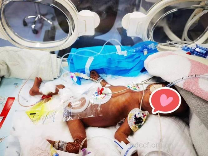 怀孕六个月胎儿图