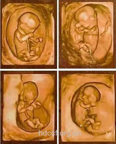怀孕五个月胎儿图(男女胎儿b超图)