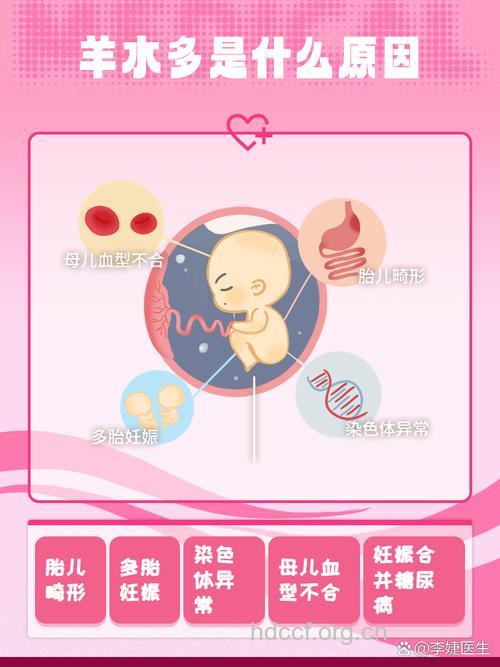 孕妇羊水偏多是怎么回事