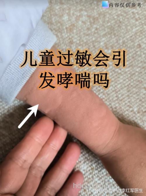 小儿哮喘和过敏有关吗?