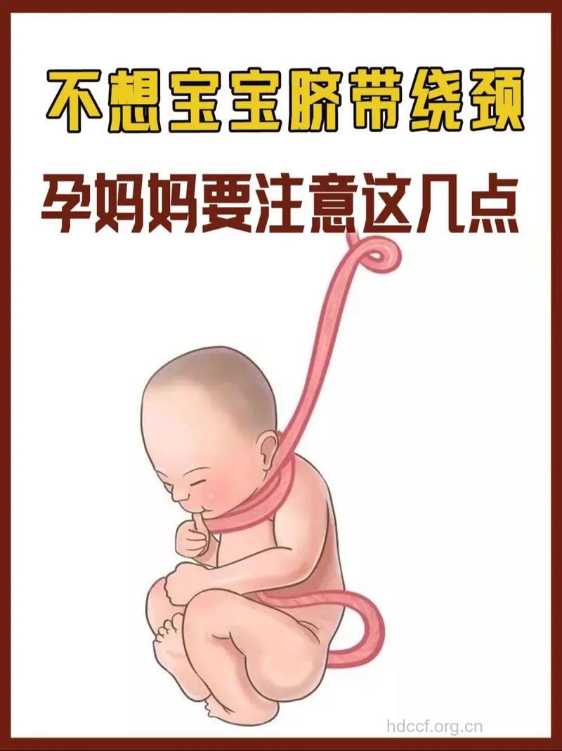 孕晚期该如何预防胎儿脐带绕颈