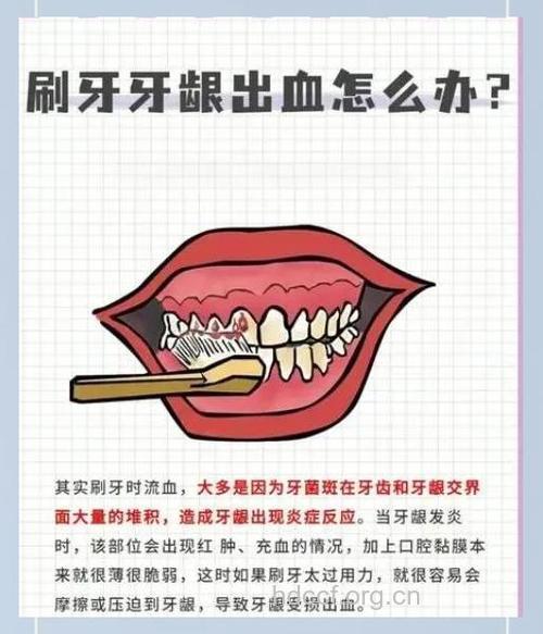 孕妇为什么刷牙时易流血