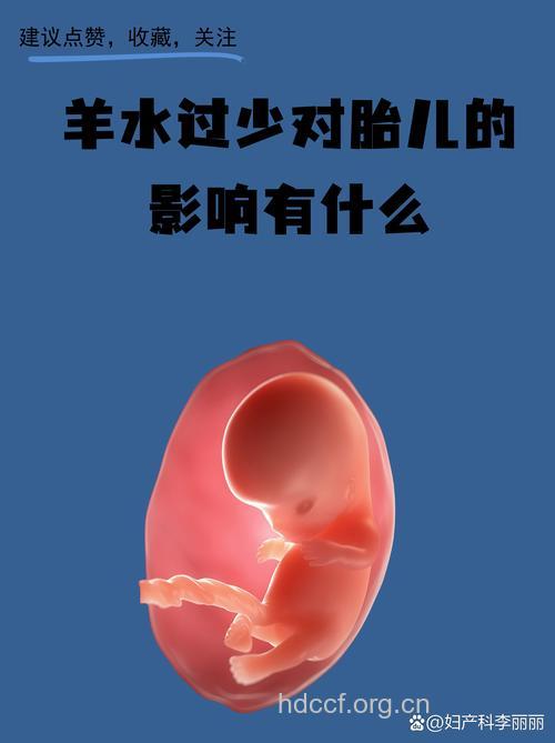 羊水少对胎儿有什么影响 小心胎儿畸形