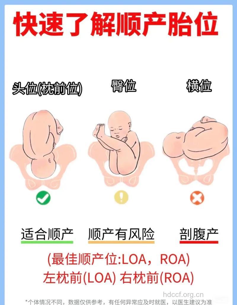 图示胎位 怀孕29周胎儿胎位图