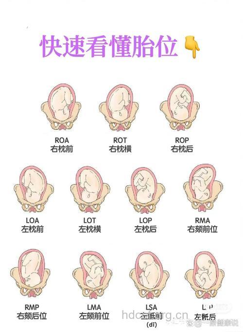 图示胎位 怀孕36周胎儿胎位图