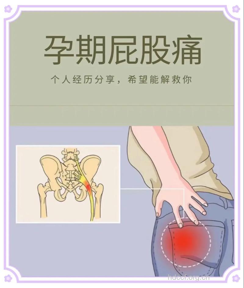 孕妇臀部酸胀怎么回事