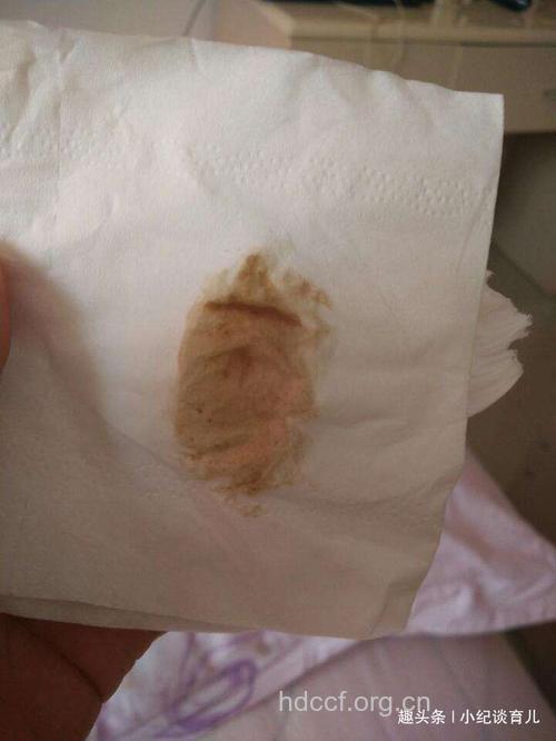 怀孕后有褐色分泌物