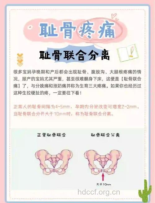 孕妇骨盆疼是怎么回事