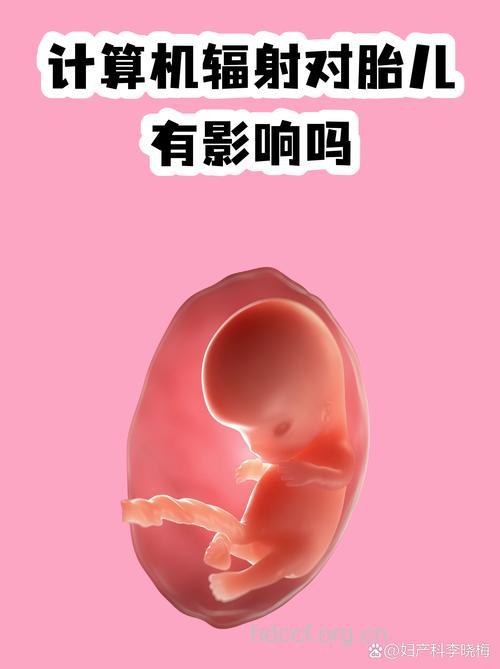 电脑辐射对孕妇有影响吗