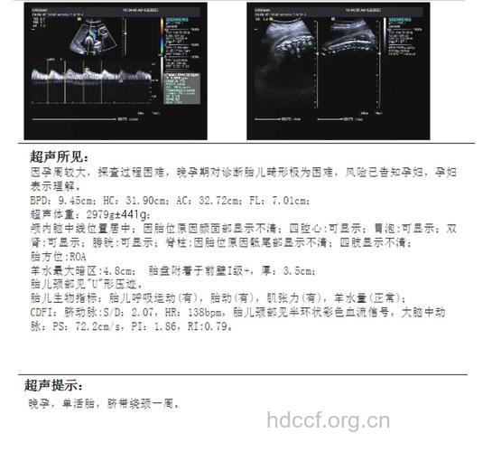 孕妈彩超单子上的ROA代表什么呢