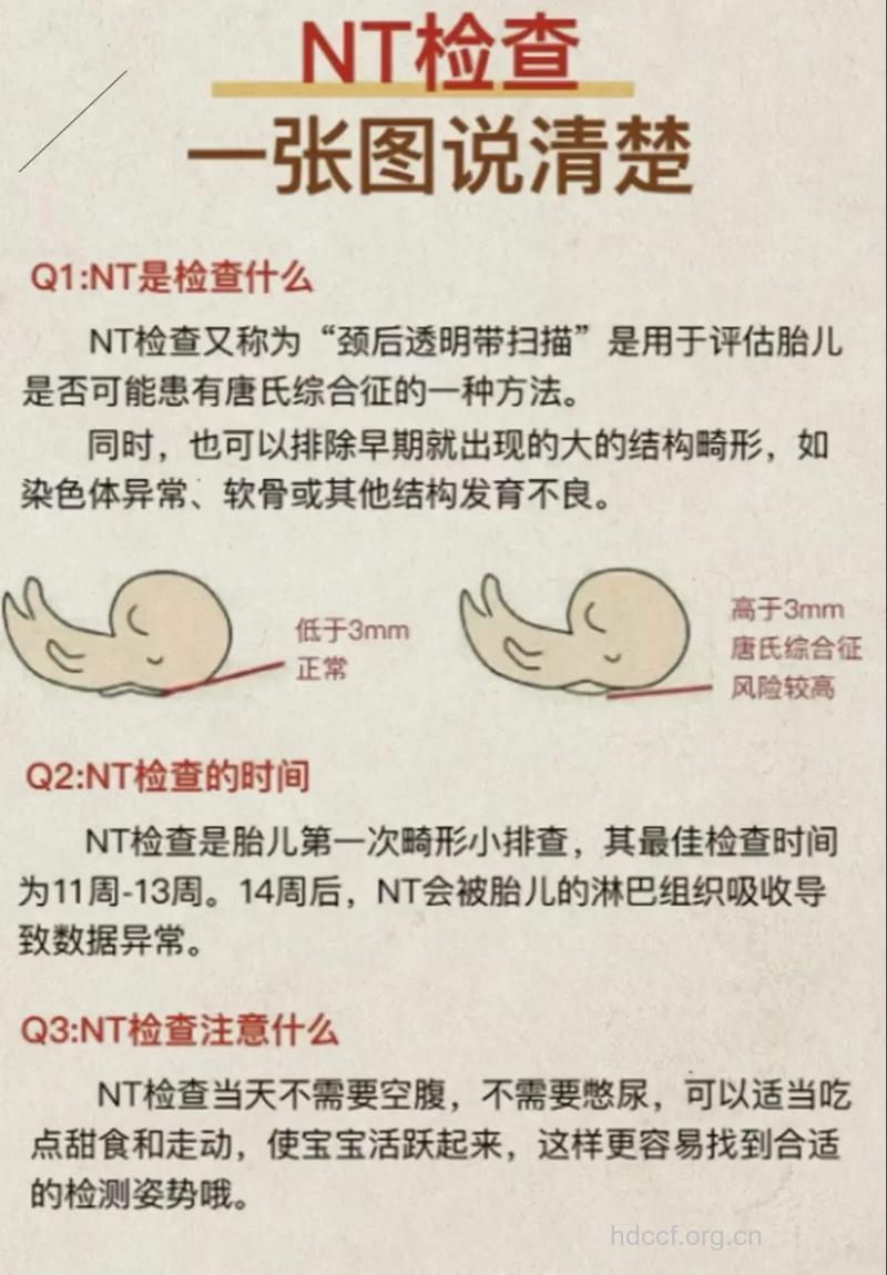 产检NT检查那些事儿