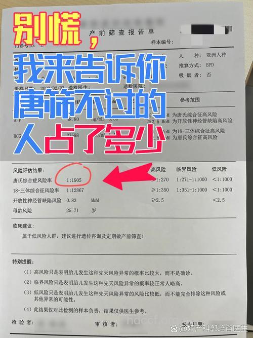 唐氏筛查有4大程序 唐氏筛查1项是什么