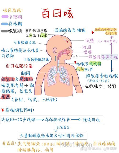小儿百日咳的病因是什么