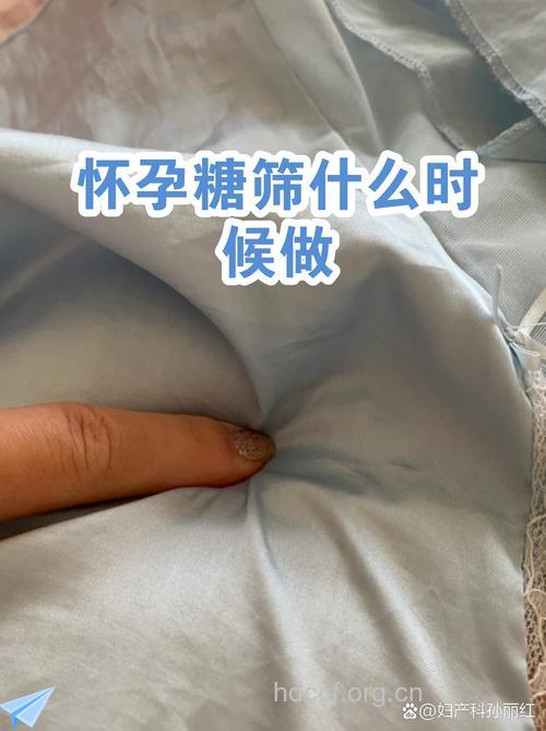 什么是糖筛 糖筛什么时候做最好