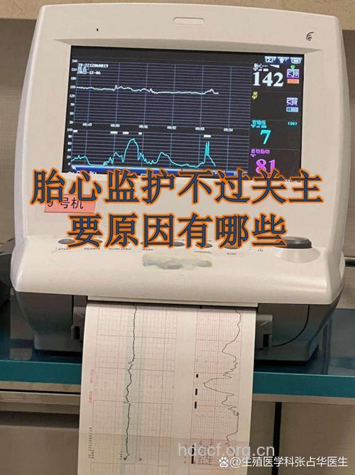 孕期做好这些检查 胎儿异常逃不过