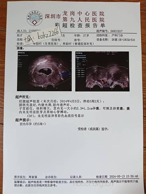 了解胎儿情况 孕期B超检查单怎么看