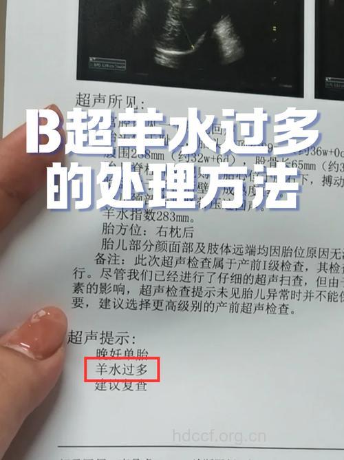 孕期羊水偏多 都有哪些检查要进行