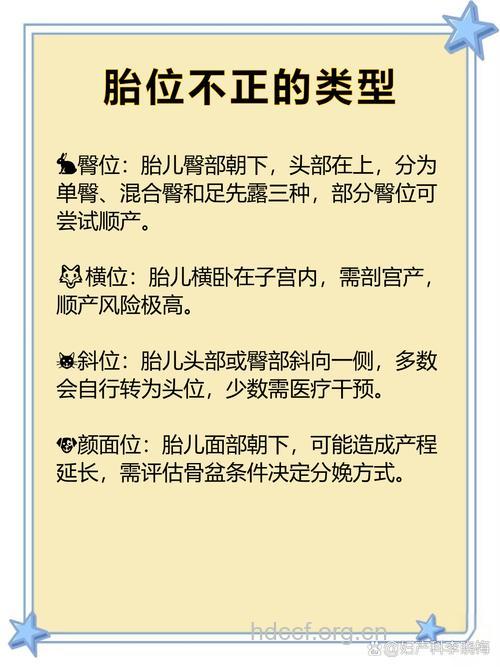 孕妇胎位不正能顺产吗？